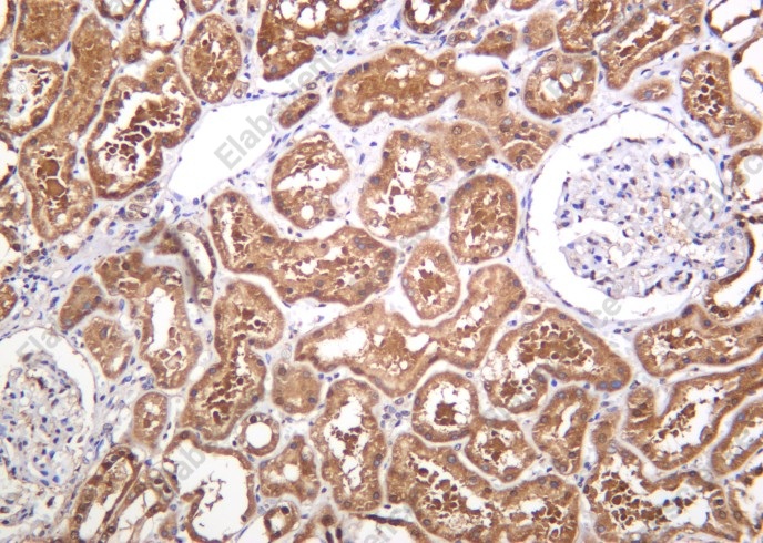 Recombinant PGK1 Monoclonal Antibody - 1