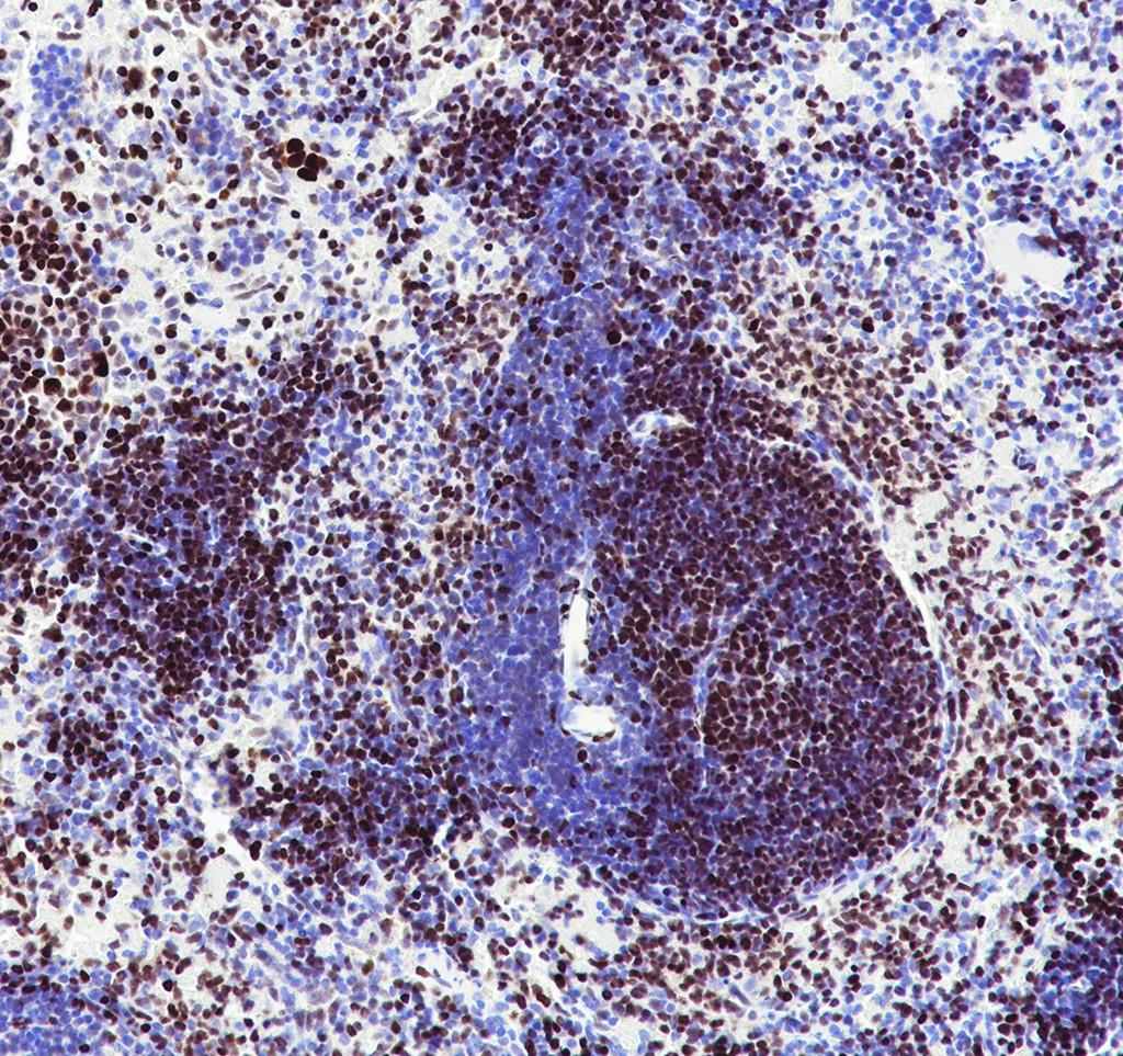 Recombinant MEF2C Monoclonal Antibody - small - 3