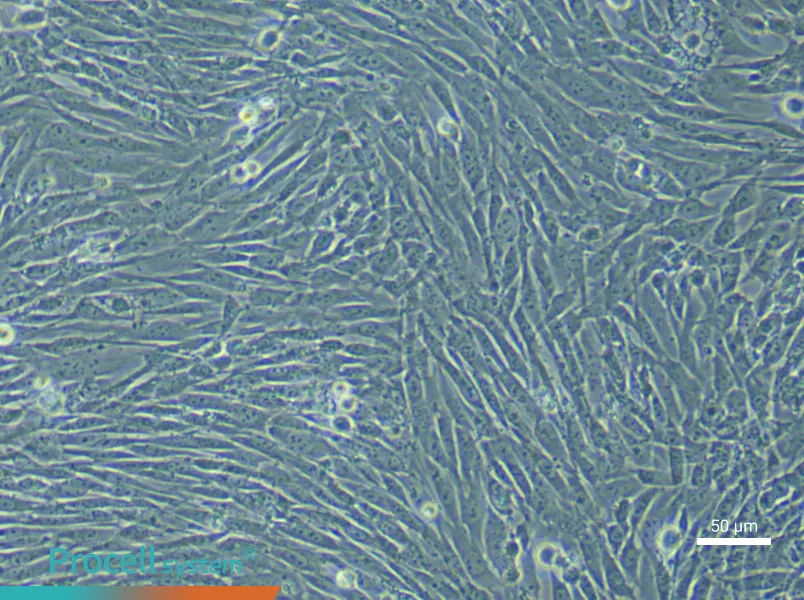 Mouse Pancreatic Stellate (Primary cell immortalization) Cell Complete MediumMouse Pancreatic Stellate (Primary cell immortalization) Cell Complete Medium - 4
