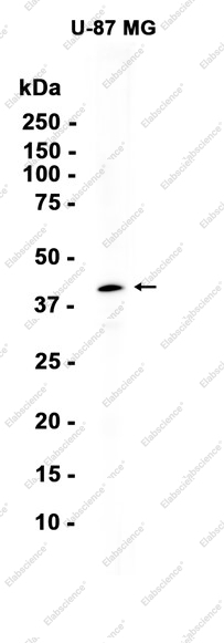 Recombinant EDG2 Monoclonal Antibody - 1