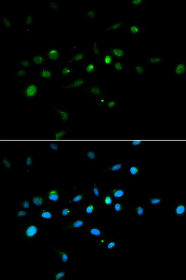 Immunofluorescence analysis of A549 cells using TRIM63 Polyclonal Antibody