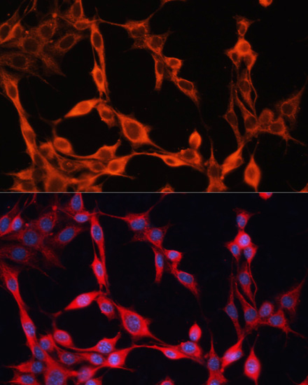 Immunofluorescence analysis of NIH/3T3 cells using SLC25A23 Polyclonal Antibody at dilution of  1:100. Blue: DAPI for nuclear staining.