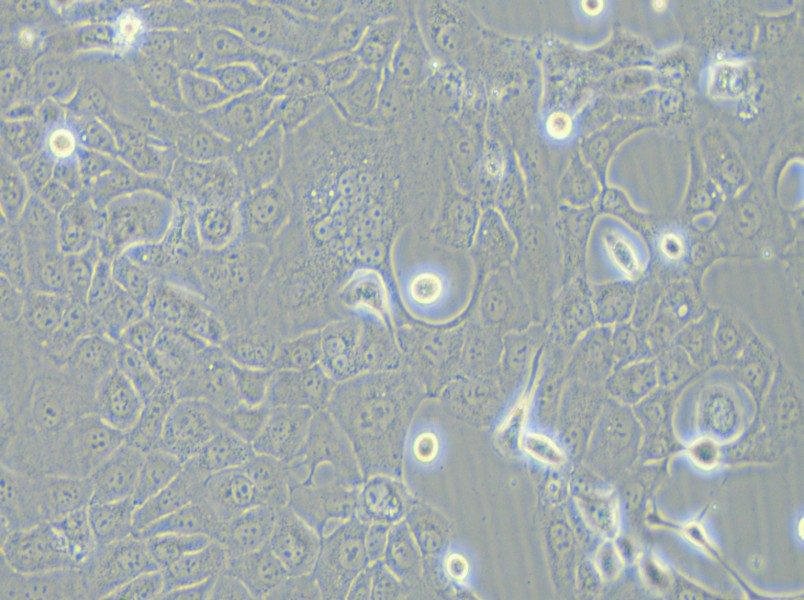 HCC-78 Cell Complete Medium - 6