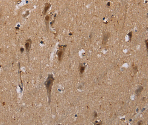 GTF2I Polyclonal Antibody - 3