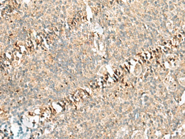 Immunohistochemistry of paraffin-embedded Human tonsil tissue  using RABGGTA Polyclonal Antibody at dilution of 1:50(?200)