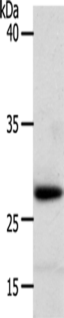 Western Blot analysis of Human liver cancer tissue using RARRES1 Polyclonal Antibody at dilution of 1:300