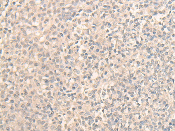 Immunohistochemistry of paraffin-embedded Human tonsil tissue  using DDX59 Polyclonal Antibody at dilution of 1:30(?200)