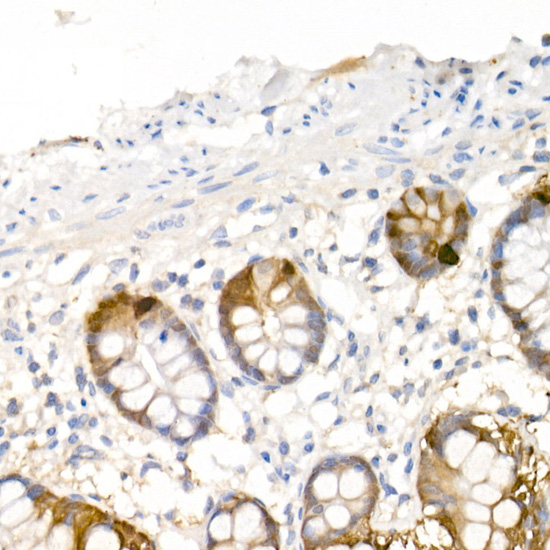 Immunohistochemistry of paraffin-embedded human small intestine using DDC Polyclonal Antibody at dilution of 1:20 (40x lens).Perform high pressure antigen retrieval with 10 mM citrate buffer pH 6.0 before commencing with IHC staining protocol.