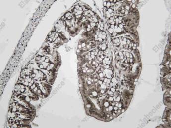 Recombinant EWS Monoclonal Antibody - 3