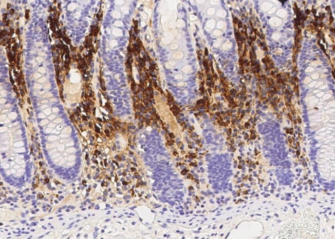 Recombinant PERP1/MZB1 Monoclonal Antibody - small - 2