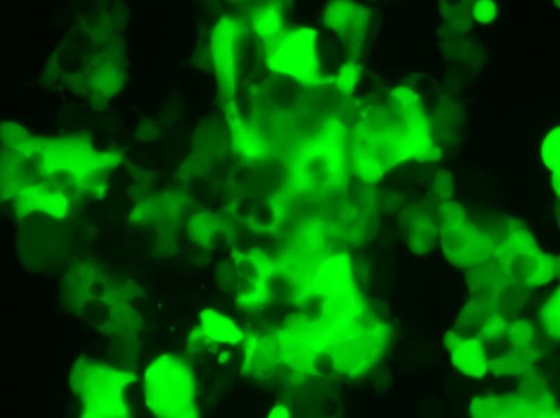 MCF7-LUC-EGFP Cell Complete Medium - small - 5