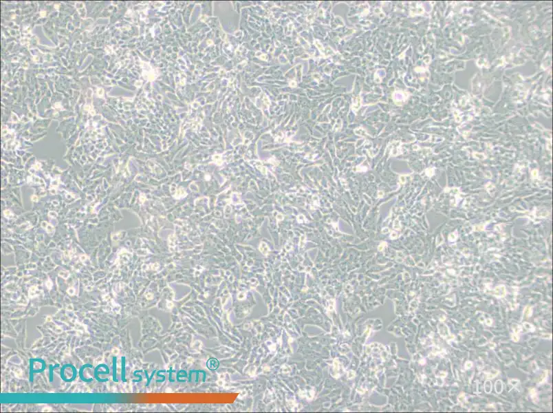 NCI-H295R Cell Complete Medium - 3
