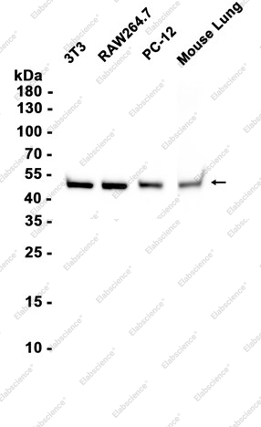 Recombinant beta II Tubulin Monoclonal Antibody - 2