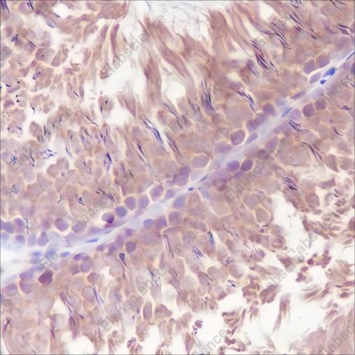 Recombinant LysRS Monoclonal Antibody - 4