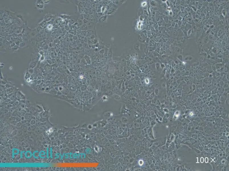 Ca Ski Cell Complete Medium - 3