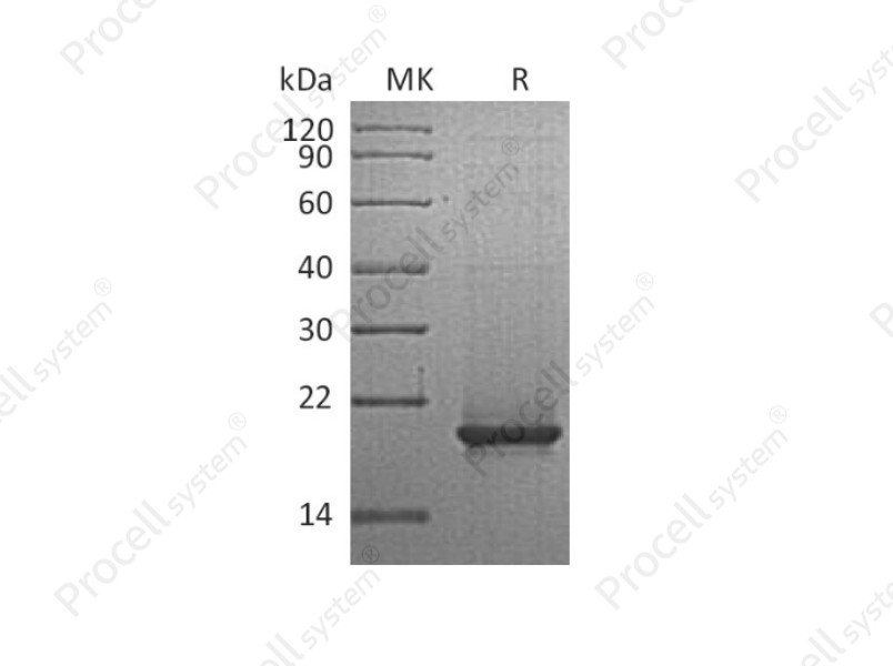 RANKL/TNFSF11/TRANCE/CD254, Human, Recombinant