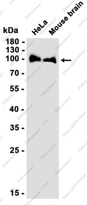 Recombinant VPS41 Monoclonal Antibody - 2
