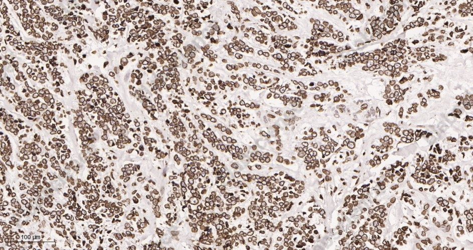 Recombinant Lamin B1 Monoclonal Antibody - 2