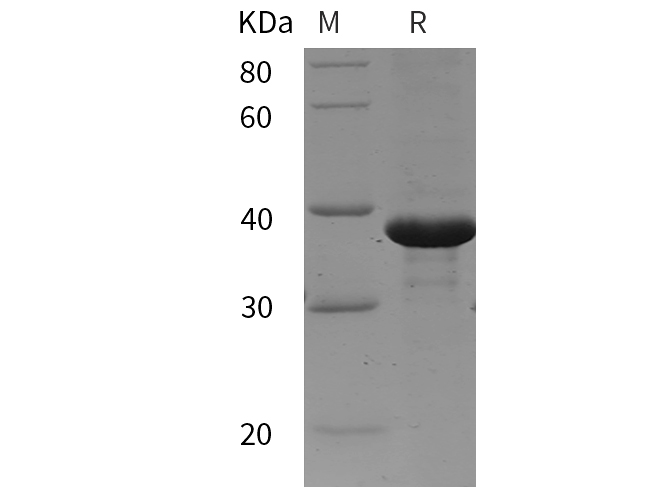 Recombinant mouse TGF-beta 2/TGFB2 Protein(His Tag)-1