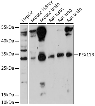 Western blot analysis of extracts of various cell lines using PEX11B Polyclonal Antibody at 1:1000 dilution.