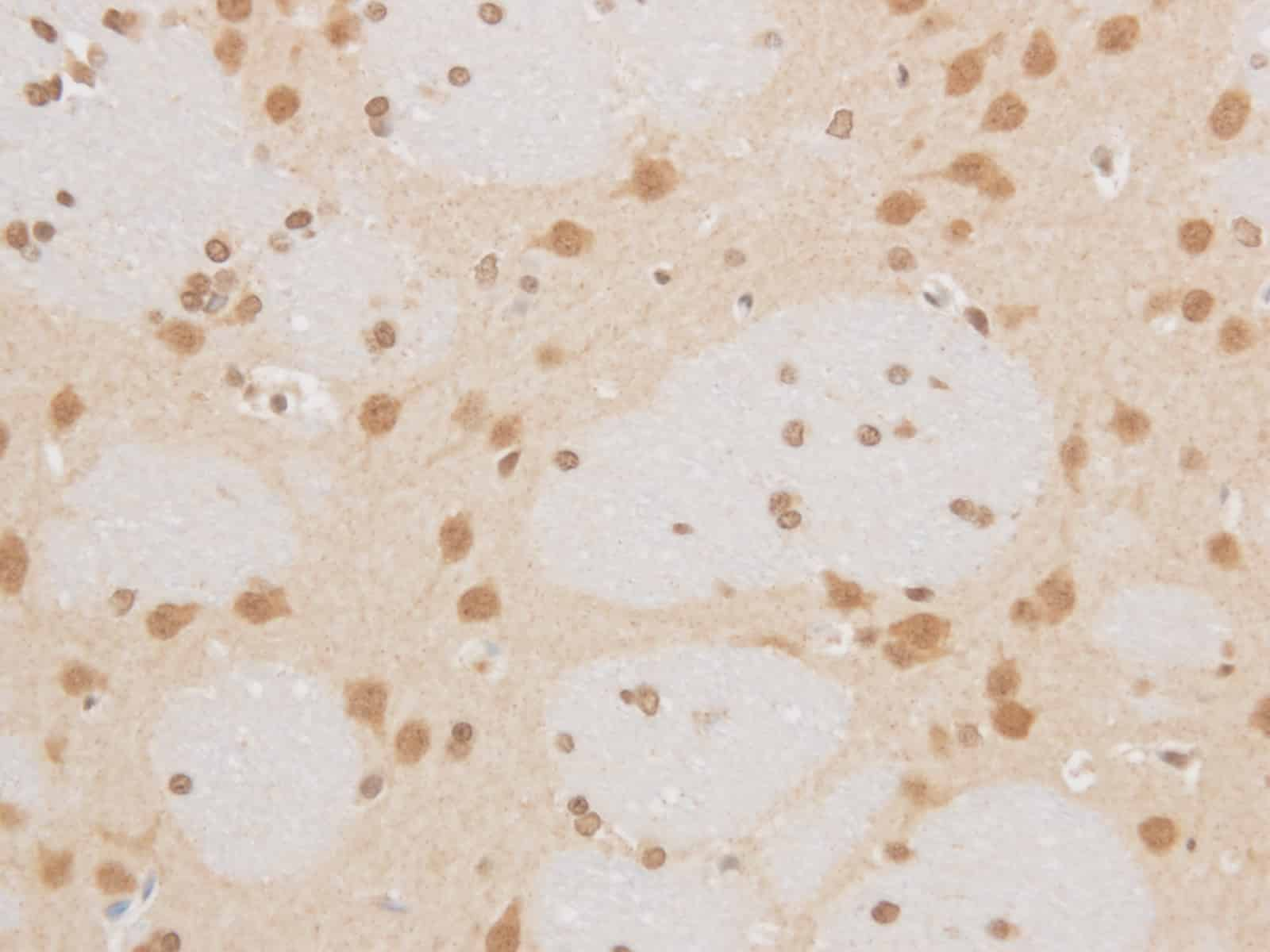 Immunohistochemistry of paraffin-embedded Rat brain using MAP2K6 Polyclonal Antibody at dilution of 1:50