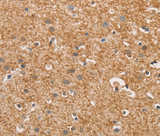 Immunohistochemistry of paraffin-embedded Human brain using CYP4A11 Polyclonal Antibody at dilution of 1:30