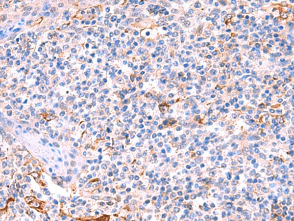 Immunohistochemistry of paraffin-embedded Human tonsil tissue  using FUCA2 Polyclonal Antibody at dilution of 1:70(?200)