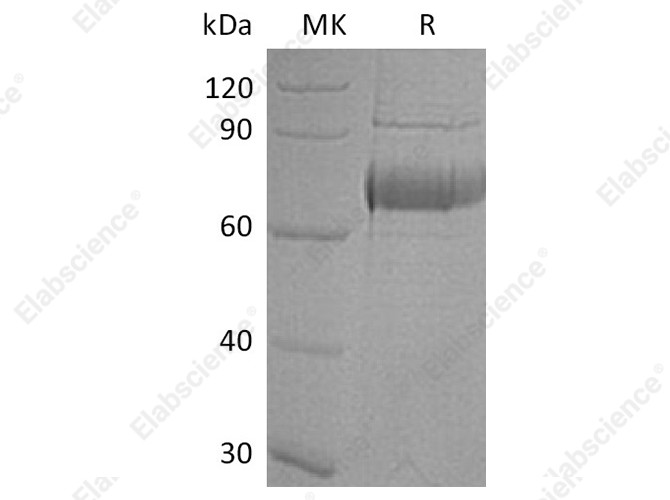 Recombinant Human OLFM4 Protein (His Tag) - 1