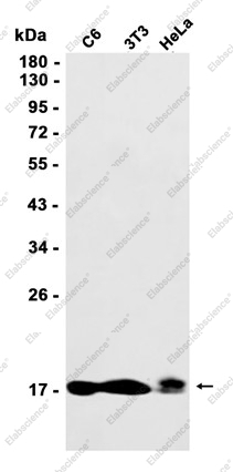Recombinant Niemann Pick C2 Monoclonal Antibody - 1