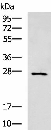 Western blot analysis of Mouse small intestines tissue lysate  using CIDEC Polyclonal Antibody at dilution of 1:400