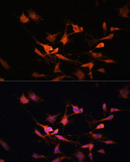 Immunofluorescence analysis of C6 cells using KEAP1 Polyclonal Antibody at dilution of  1:100. Blue: DAPI for nuclear staining.