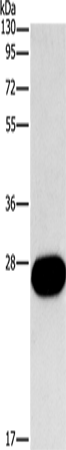 Western Blot analysis of Mouse kidney tissue using FGF9 Polyclonal Antibody at dilution of 1:800