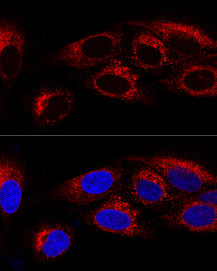 Confocal immunofluorescence analysis of U2OS cells using CKAP4 Polyclonal Antibody at dilution of 1:100. Blue: DAPI for nuclear staining.