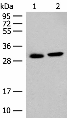 Western blot analysis of Mouse kidney tissue and Human kidney tissue lysates  using GLYAT Polyclonal Antibody at dilution of 1:300