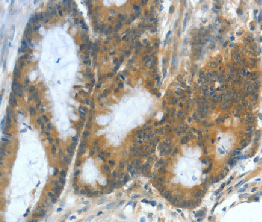 ASNS Polyclonal Antibody - 2
