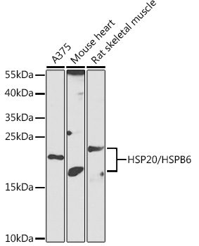 Western blot analysis of extracts of various cell lines using HSP20/HSP20/HSPB6 Polyclonal Antibody at 1:1000 dilution.