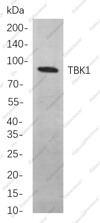 Recombinant TBK1 Monoclonal Antibody - 1