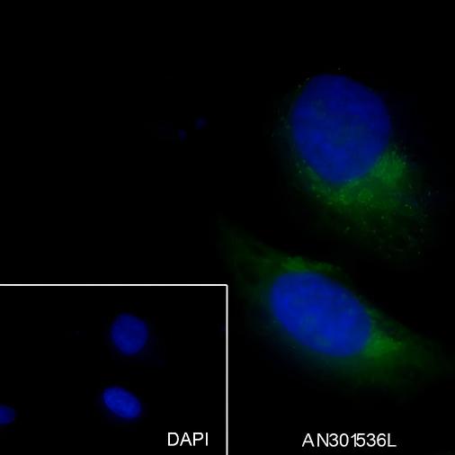 Recombinant GOSR1/GS28 Monoclonal Antibody - small - 4