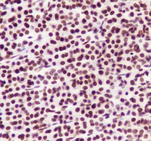 Recombinant MBD2 Monoclonal Antibody - small - 5