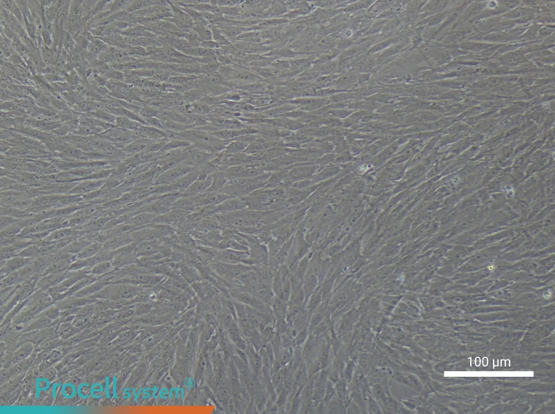 Human Cardiac Fibroblast Complete MediumHuman Cardiac Fibroblast Complete Medium - 3