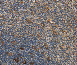GGT1 Polyclonal Antibody - 2