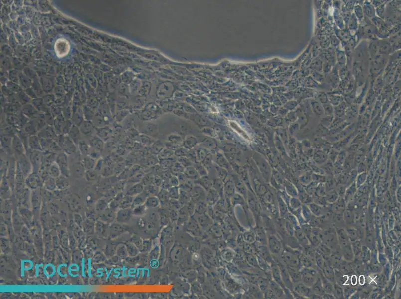 Calu-3 Cell Complete Medium - 6