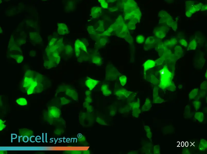 Hep G2-GFP - 5