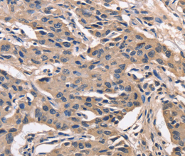 PEBP1 Polyclonal Antibody - 3