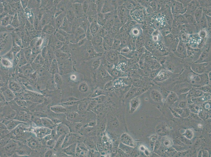 NCI-H1666 Cell Complete Medium - 6