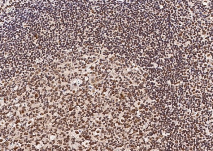 Recombinant HSF1 Monoclonal Antibody - small - 2