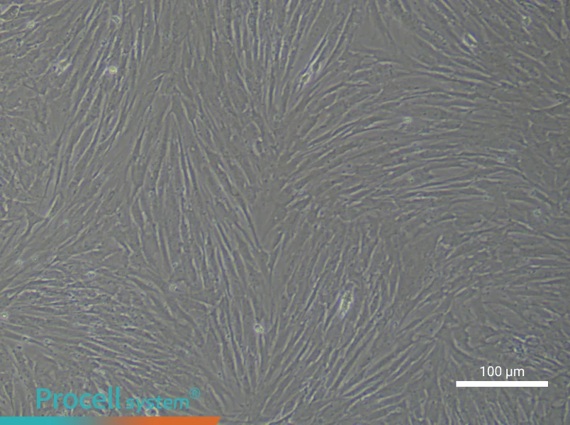 Human Synovial Cell Complete Medium - 3