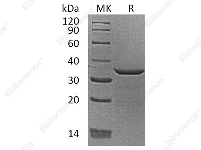 Recombinant Human Proenkephalin-B/PDYN Protein (His Tag) - 1