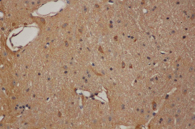 Purified Anti-Mouse NKG2A/C/E Antibody[20D5]-产品推荐-1