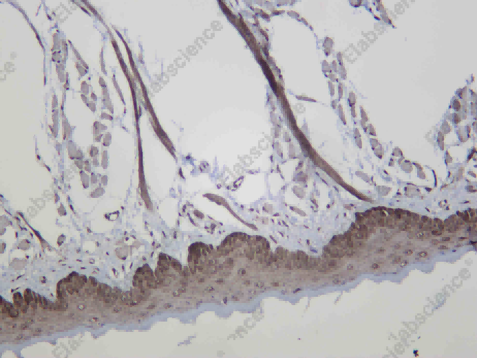 Recombinant SIRT2 Monoclonal Antibody - 4